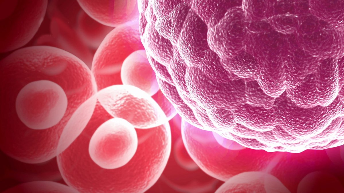 What If Cancer Holds the Key to New Treatments for Alzheimer’s Disease?